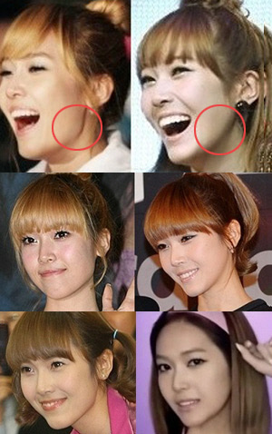 Sunny Snsd Plastic Surgery on Plastic Fantastic  Iu   S Face Is Real  But Jessica   S May Not Be